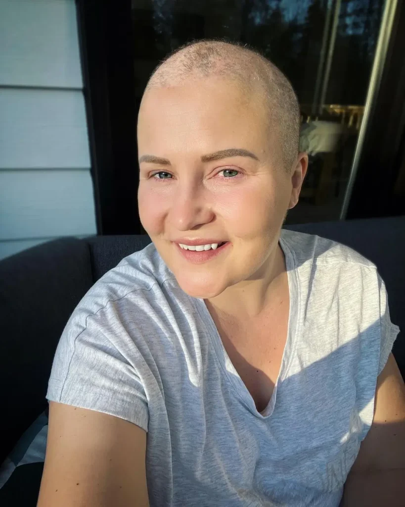 Breast Cancer Survivor — The Honest Talk